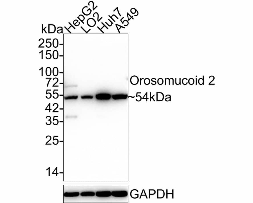 Western blot analysis on different lysates with NBP3-32680 at 1/2,000 dilution. Lane 1: HepG2 cell lysate Lane 2: LO2 cell lysate Lane 3: Huh7 cell lysate Lane 4: A549 cell lysate Lysates/proteins at 25 µg/Lane. Predicted band size: 24 kDa Observed band size: 54 kDa Exposure time: 25 seconds; 4-20% SDS-PAGE gel. Proteins were transferred to a PVDF membrane and blocked with 5% NFDM/TBST for 1 hour at room temperature. NBP3-32680 at 1/2,000 dilution was used in 5% NFDM/TBST at 4℃ overnight. Goat Anti-Rabbit IgG [HRP] Secondary Antibody at 1/50,000 dilution was used for 1 hour at room temperature.