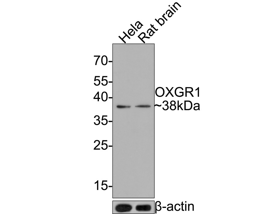 Western Blot: OXGR1/GPR80/P2Y15 Antibody (JE64-04) [NBP3-32684] - Western blot analysis of OXGR1/GPR80/P2Y15 on different lysates with Rabbit anti-OXGR1/GPR80/P2Y15 antibody (NBP3-32684) at 1/500 dilution. Lane 1: Hela cell lysate (10 ug/Lane) Lane 2: Rat brain tissue lysate (20 ug/Lane)  Predicted band size: 38 kDa Observed band size: 38 kDa Exposure time: 2 minutes; 12% SDS-PAGE gel. Proteins were transferred to a PVDF membrane and blocked with 5% NFDM/TBST for 1 hour at room temperature. The primary antibody (NBP3-32684) at 1/500 dilution was used in 5% NFDM/TBST at room temperature for 2 hours. Goat Anti-Rabbit IgG - HRP Secondary Antibody at 1:300,000 dilution was used for 1 hour at room temperature.