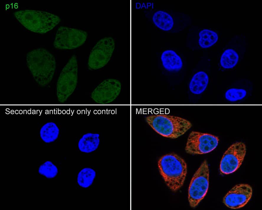 Immunocytochemistry/ Immunofluorescence: p16INK4a/CDKN2A Antibody (PD01-16) [NBP3-32688] - Immunocytochemistry analysis of HeLa cells labeling p16INK4a/CDKN2A with Mouse anti-p16INK4a/CDKN2AINK4a/CDKN2A antibody (NBP3-32688) at 1/100 dilution. Cells were fixed in 4% paraformaldehyde for 20 minutes at room temperature, permeabilized with 0.1% Triton X-100 in PBS for 5 minutes at room temperature, then blocked with 1% BSA in 10% negative goat serum for 1 hour at room temperature. Cells were then incubated with Mouse anti-p16INK4a/CDKN2A antibody (NBP3-32688) at 1/100 dilution in 1% BSA in PBST overnight at 4 ℃. Goat Anti-Mouse IgG H&L (iFluor™ 488) was used as the secondary antibody at 1/1,000 dilution. PBS instead of the primary antibody was used as the secondary antibody only control. Nuclear DNA was labelled in blue with DAPI. beta Tubulin (red) was stained at 1/100 dilution overnight at +4℃. Goat Anti-Rabbit IgG H&L (iFluor™ 594) were used as the secondary antibody at 1/1,000 dilution.