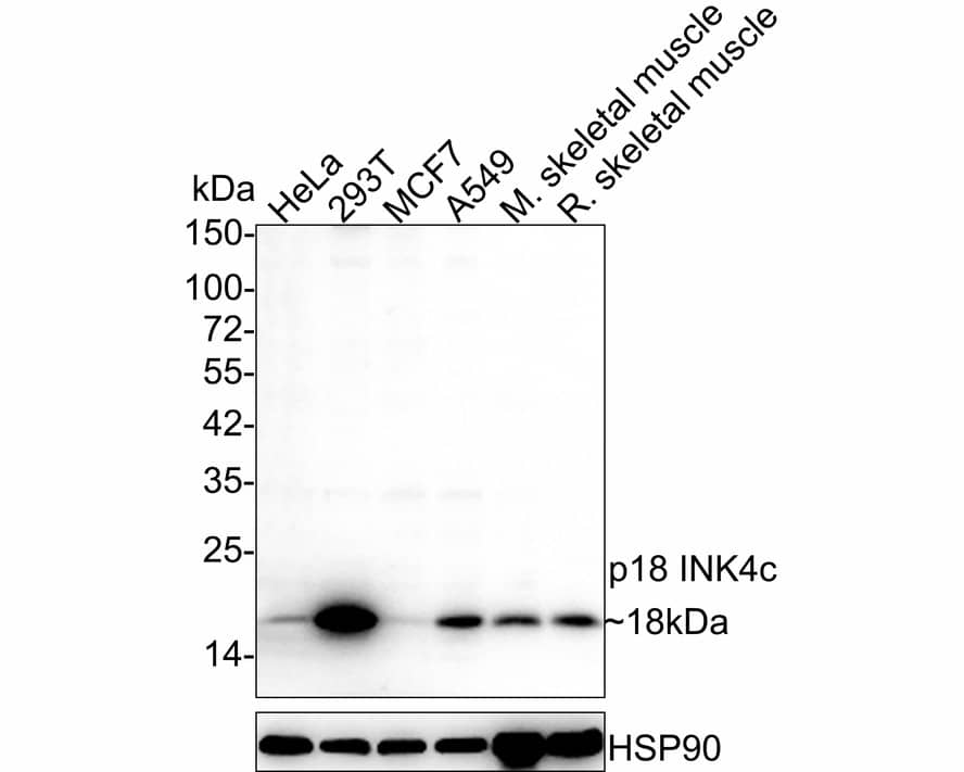 Western Blot: p18INK4c/CDKN2C Antibody (JE36-09) [NBP3-32690] - Western blot analysis of p18INK4c/CDKN2C on different lysates with Rabbit anti-p18INK4c/CDKN2C antibody (NBP3-32690) at 1/1,000 dilution. Lane 1: HeLa cell lysate (20 ug/Lane) Lane 2: 293T cell lysate (20 ug/Lane) Lane 3: MCF7 cell lysate (20 ug/Lane) Lane 4: A549 cell lysate (20 ug/Lane) Lane 5: Mouse skeletal muscle tissue lysate (40 ug/Lane) Lane 6: Rat skeletal muscle tissue lysate (40 ug/Lane) Predicted band size: 18 kDa Observed band size: 18 kDa Exposure time: 3 minutes; 4-20% SDS-PAGE gel. Proteins were transferred to a PVDF membrane and blocked with 5% NFDM/TBST for 1 hour at room temperature. The primary antibody (NBP3-32690) at 1/1,000 dilution was used in 5% NFDM/TBST at 4  overnight. Goat Anti-Rabbit IgG - HRP Secondary Antibody at 1/50,000 dilution was used for 1 hour at room temperature.