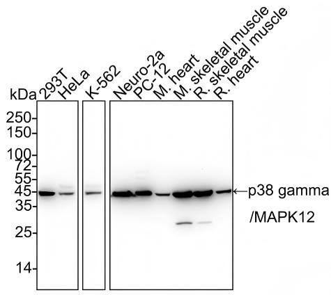 Western blot analysis on different lysates with NBP3-32693 at 1/2,000 dilution and competitor's antibody at 1/2,000 dilution. Lane 1: 293T cell lysate Lane 2: HeLa cell lysate Lane 3: K-562 cell lysate Lane 4: Neuro-2a cell lysate Lane 5: PC-12 cell lysate Lane 6: Mouse heart tissue lysate Lane 7: Mouse skeletal muscle tissue lysate Lane 8: Rat skeletal muscle tissue lysate Lane 9: Rat heart tissue lysate Lysates/proteins at 30 µg/Lane. Predicted band size: 42 kDa Observed band size: 42 kDa Exposure time: 40 seconds; 4-20% SDS-PAGE gel. Proteins were transferred to a PVDF membrane and blocked with 5% NFDM/TBST for 1 hour at room temperature. NBP3-32693 at 1/2,000 dilution and competitor's antibody at 1/2,000 dilution were used in 5% NFDM/TBST at 4℃ overnight. Goat Anti-Rabbit IgG [HRP] Secondary Antibody at 1/50,000 dilution was used for 1 hour at room temperature.