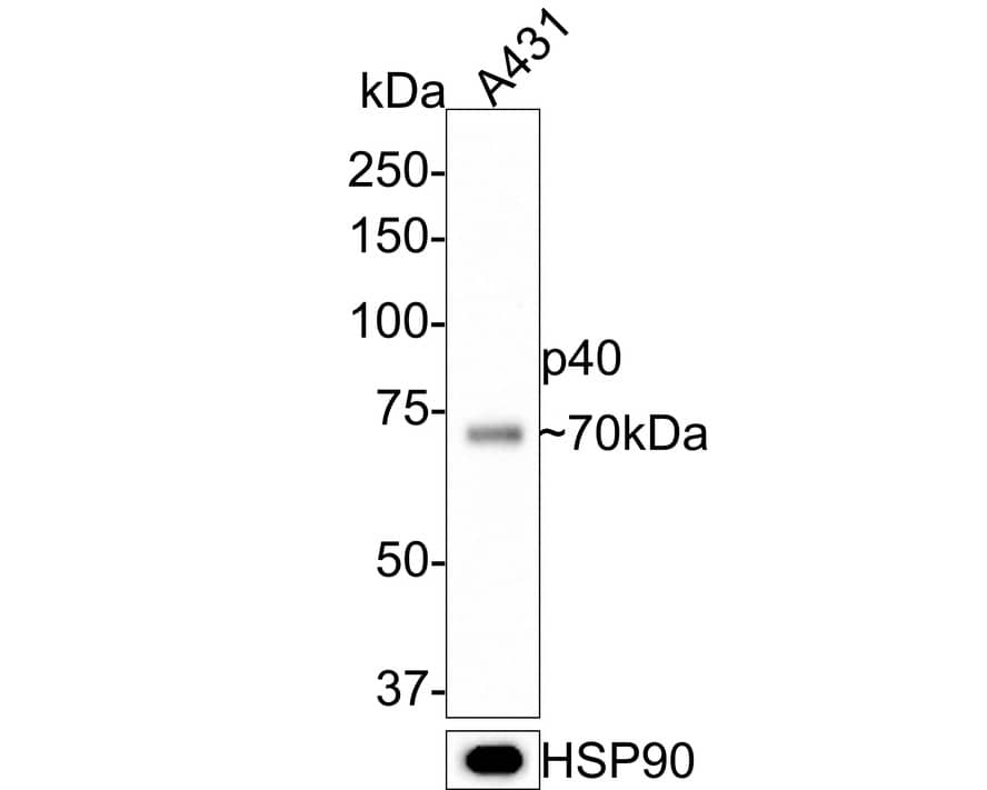 Western Blot: p40/deltaNp63 Antibody (PDH0-02) [NBP3-32694] - Western blot analysis of p40/deltaNp63 on A431 cell lysates with Rabbit anti-p40/deltaNp63 antibody (NBP3-32694) at 1/1,000 dilution. Lysates/proteins at 10 ug/Lane. Predicted band size: 77 kDa Observed band size: 70 kDa Exposure time: 3 minutes; 8% SDS-PAGE gel. Proteins were transferred to a PVDF membrane and blocked with 5% NFDM/TBST for 1 hour at room temperature. The primary antibody (NBP3-32694) at 1/1,000 dilution was used in 5% NFDM/TBST at room temperature for 2 hours. Goat Anti-Rabbit IgG - HRP Secondary Antibody at 1:300,000 dilution was used for 1 hour at room temperature.