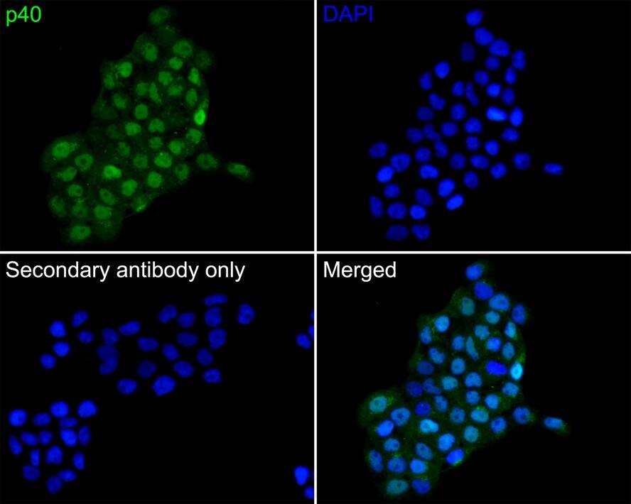 Immunocytochemistry/ Immunofluorescence: p40/deltaNp63 Antibody (PDH0-02) [NBP3-32694] - Immunocytochemistry analysis of A431 cells labeling p40/deltaNp63 with Rabbit anti-p40/deltaNp63 antibody (NBP3-32694) at 1/100 dilution. Cells were fixed in 4% paraformaldehyde for 10 minutes at 37 ℃, permeabilized with 0.05% Triton X-100 in PBS for 20 minutes, and then blocked with 2% negative goat serum for 30 minutes at room temperature. Cells were then incubated with Rabbit anti-p40/deltaNp63 antibody (NBP3-32694) at 1/100 dilution in 2% negative goat serum overnight at 4 ℃. Goat Anti-Rabbit IgG H&L (iFluor™ 488) was used as the secondary antibody at 1/1,000 dilution. PBS instead of the primary antibody was used as the secondary antibody only control. Nuclear DNA was labelled in blue with DAPI.