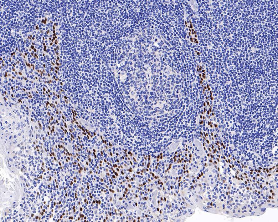 Immunohistochemistry: p40/deltaNp63 Antibody (PDH0-02) [NBP3-32694] - Immunohistochemical analysis of paraffin-embedded human tonsil tissue with Rabbit anti-p40/deltaNp63 antibody (NBP3-32694) at 1/1,000 dilution. The section was pre-treated using heat mediated antigen retrieval with sodium citrate buffer (pH 6.0) for 2 minutes. The tissues were blocked in 1% BSA for 20 minutes at room temperature, washed with ddH2O and PBS, and then probed with the primary antibody (NBP3-32694) at 1/1,000 dilution for 1 hour at room temperature. The detection was performed using an HRP conjugated compact polymer system. DAB was used as the chromogen. Tissues were counterstained with hematoxylin and mounted with DPX.