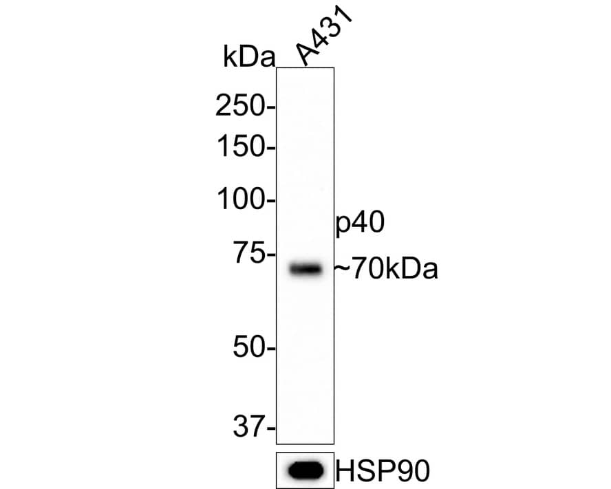 Western Blot: p40/deltaNp63 Antibody (PDH0-06) [NBP3-32695] - Western blot analysis of p40/deltaNp63 on A431 cell lysates with Rabbit anti-p40/deltaNp63 antibody (NBP3-32695) at 1/1,000 dilution. Lysates/proteins at 10 ug/Lane. Predicted band size: 77 kDa Observed band size: 70 kDa Exposure time: 3 minutes; 8% SDS-PAGE gel. Proteins were transferred to a PVDF membrane and blocked with 5% NFDM/TBST for 1 hour at room temperature. The primary antibody (NBP3-32695) at 1/1,000 dilution was used in 5% NFDM/TBST at room temperature for 2 hours. Goat Anti-Rabbit IgG - HRP Secondary Antibody at 1:300,000 dilution was used for 1 hour at room temperature.