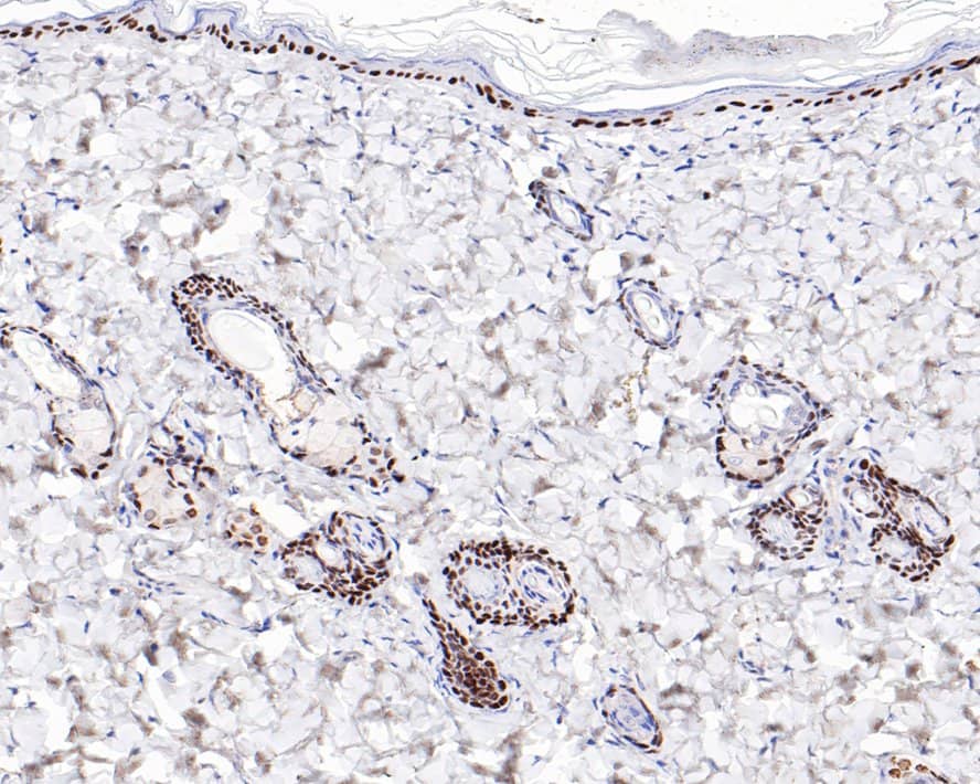 Immunohistochemistry: p40/deltaNp63 Antibody (PDH0-06) [NBP3-32695] - Immunohistochemical analysis of paraffin-embedded rat skin tissue with Rabbit anti-p40/deltaNp63 antibody (NBP3-32695) at 1/2,000 dilution. The section was pre-treated using heat mediated antigen retrieval with sodium citrate buffer (pH 6.0) for 2 minutes. The tissues were blocked in 1% BSA for 20 minutes at room temperature, washed with ddH2O and PBS, and then probed with the primary antibody (NBP3-32695) at 1/2,000 dilution for 1 hour at room temperature. The detection was performed using an HRP conjugated compact polymer system. DAB was used as the chromogen. Tissues were counterstained with hematoxylin and mounted with DPX.