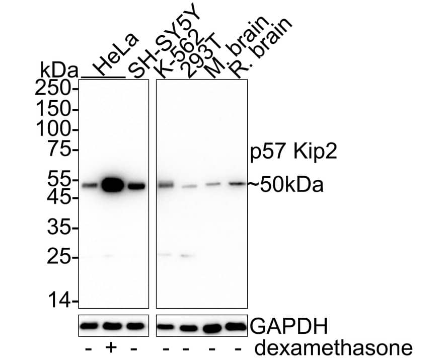 Western blot analysis on different lysates with NBP3-32701 at 1/1,000 dilution. Lane 1: HeLa cell lysate (20 µg/Lane) Lane 2: HeLa treated with 50nM dexamethasone for 16 hours cell lysate (20 µg/Lane) Lane 3: SH-SY5Y cell lysate (20 µg/Lane) Lane 4: K-562 cell lysate (20 µg/Lane) Lane 5: 293T cell lysate (20 µg/Lane) Lane 6: Mouse brain tissue lysate (40 µg/Lane) Lane 7: Rat brain tissue lysate (40 µg/Lane) Predicted band size: 32 kDa Observed band size: 50 kDa Exposure time: Lane 1-3: 59 seconds; Lane 4-7: 3 minutes;  4-20% SDS-PAGE gel. Proteins were transferred to a PVDF membrane and blocked with 5% NFDM/TBST for 1 hour at room temperature. NBP3-32701 at 1/1,000 dilution was used in 5% NFDM/TBST at 4℃ overnight. Goat Anti-Rabbit IgG [HRP] Secondary Antibody at 1/50,000 dilution was used for 1 hour at room temperature.