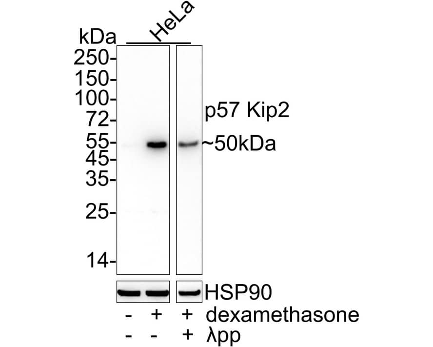 Western blot analysis on different lysates with NBP3-32701 at 1/5,000 dilution. Lane 1: HeLa cell lysate Lane 2: HeLa treated with 50nM dexamethasone for 16 hours cell lysate Lane 3: HeLa treated with 50nM dexamethasone for 16 hours cell lysate, then the membrane treated with  lambda pp for 1 hour Lysates/proteins at 15 µg/Lane. Predicted band size: 32 kDa Observed band size: 50 kDa Exposure time: 59 seconds;  4-20% SDS-PAGE gel. Proteins were transferred to a PVDF membrane and blocked with 5% NFDM/TBST for 1 hour at room temperature. NBP3-32701 at 1/5,000 dilution was used in 5% NFDM/TBST at 4℃ overnight. Goat Anti-Rabbit IgG [HRP] Secondary Antibody at 1/50,000 dilution was used for 1 hour at room temperature.