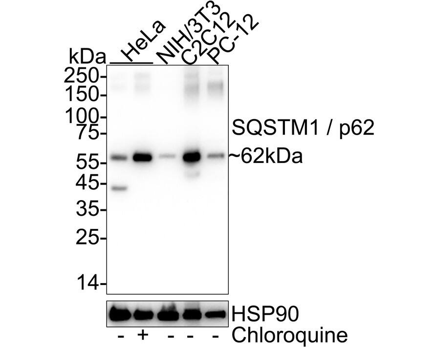 Western blot analysis on different lysates with NBP3-32702 at 1/20,000 dilution. Lane 1: HeLa cell lysate Lane 2: HeLa treated with 50μM Chloroquine for 18 hours cell lysate Lane 3: NIH/3T3 cell lysate Lane 4: C2C12 cell lysate Lane 5: PC-12 cell lysate Lysates/proteins at 20 µg/Lane. Predicted band size: 48 kDa Observed band size: 62 kDa Exposure time: 2 seconds;  4-20% SDS-PAGE gel. Proteins were transferred to a PVDF membrane and blocked with 5% NFDM/TBST for 1 hour at room temperature. NBP3-32702 at 1/20,000 dilution was used in 5% NFDM/TBST at 4℃ overnight. Goat Anti-Rabbit IgG [HRP] Secondary Antibody at 1/50,000 dilution was used for 1 hour at room temperature.