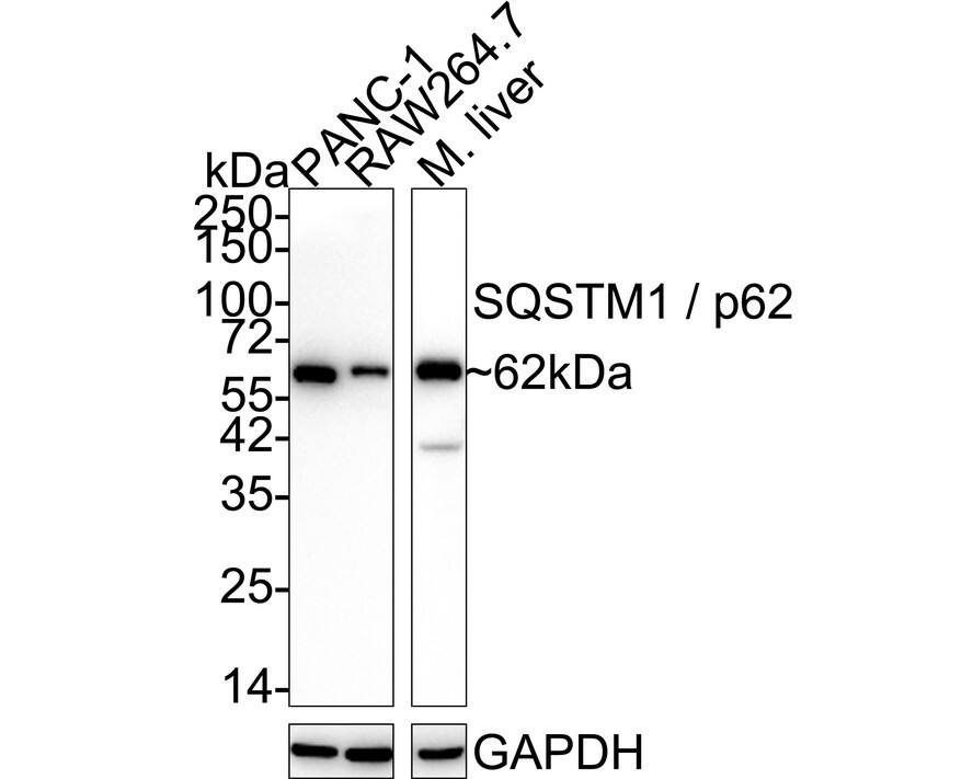 Western blot analysis on different lysates with NBP3-32702 at 1/5,000 dilution. Lane 1: PANC-1 cell lysate (10 µg/Lane) Lane 2: RAW264.7 cell lysate (10 µg/Lane) Lane 3: Mouse liver tissue lysate (20 µg/Lane) Predicted band size: 62 kDa Observed band size: 62 kDa Exposure time: 50 seconds;  4-20% SDS-PAGE gel. Proteins were transferred to a PVDF membrane and blocked with 5% NFDM/TBST for 1 hour at room temperature. NBP3-32702 at 1/5,000 dilution was used in 5% NFDM/TBST at 4℃ overnight. Goat Anti-Rabbit IgG [HRP] Secondary Antibody at 1/50,000 dilution was used for 1 hour at room temperature.