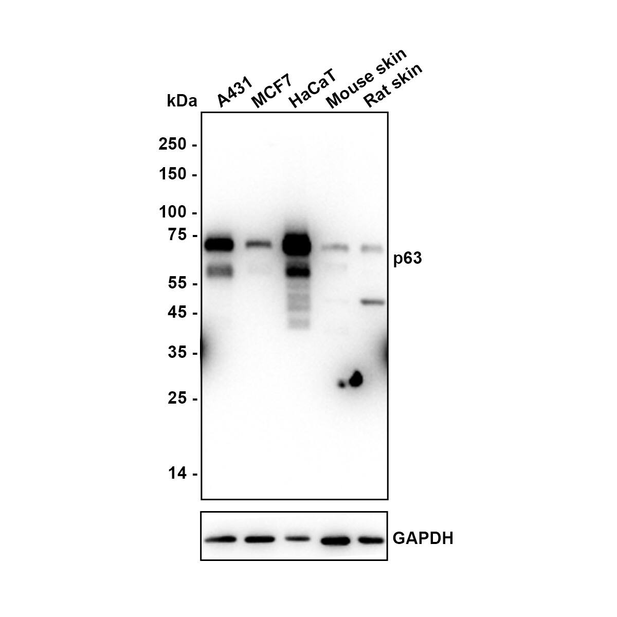 Western blot analysis on different lysates with NBP3-32703 at 1/1,000 dilution. Lane 1: A431 cell lysate (15 µg/Lane) Lane 2: MCF7 cell lysate (low expression) (15 µg/Lane) Lane 3: HaCaT cell lysate (15 µg/Lane) Lane 4: Mouse skin tissue lysate (30 µg/Lane) Lane 5: Rat skin tissue lysate (30 µg/Lane) Predicted band size: 77 kDa Observed band size: 60-70 kDa Exposure time: 10 seconds;  4-20% SDS-PAGE gel. Proteins were transferred to a PVDF membrane and blocked with 5% NFDM/TBST for 1 hour at room temperature. NBP3-32703 at 1/1,000 dilution was used in 5% NFDM/TBST at 4℃ overnight. Goat Anti-Rabbit IgG [HRP] Secondary Antibody at 1/50,000 dilution was used for 1 hour at room temperature.