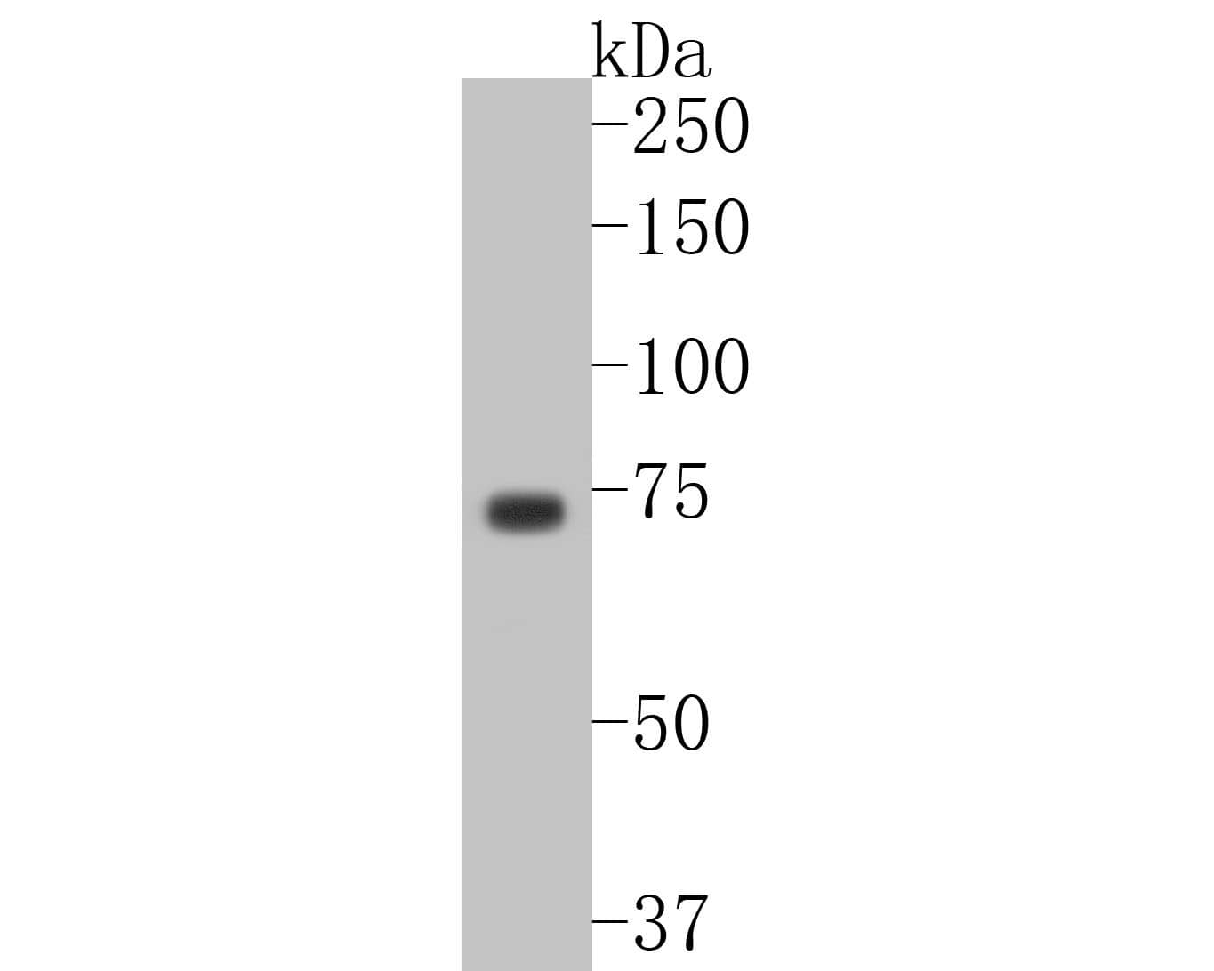 Western Blot: p63/TP73L Antibody (SC06-31) [NBP3-32703] - Western blot analysis of p63/TP73L on A431 cell lysates. Proteins were transferred to a PVDF membrane and blocked with 5% BSA in PBS for 1 hour at room temperature. The primary antibody (NBP3-32703, 1/500) was used in 5% BSA at room temperature for 2 hours. Goat Anti-Rabbit IgG - HRP Secondary Antibody at 1:5,000 dilution was used for 1 hour at room temperature.