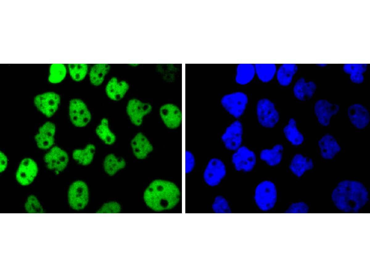 Immunocytochemistry/ Immunofluorescence: p63/TP73L Antibody (SC06-31) [NBP3-32703] - ICC staining of p63/TP73L in A431 cells (green). Formalin fixed cells were permeabilized with 0.1% Triton X-100 in TBS for 10 minutes at room temperature and blocked with 1% Blocker BSA for 15 minutes at room temperature. Cells were probed with the primary antibody (NBP3-32703, 1/50) for 1 hour at room temperature, washed with PBS. Alexa Fluor®488 Goat anti-Rabbit IgG was used as the secondary antibody at 1/1,000 dilution. The nuclear counter stain is DAPI (blue).