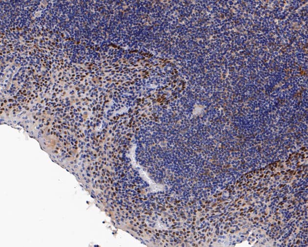 Immunohistochemistry: p63/TP73L Antibody (SC06-31) [NBP3-32703] - Immunohistochemical analysis of paraffin-embedded human tonsil tissue using anti-p63/TP73L antibody. The section was pre-treated using heat mediated antigen retrieval with sodium citrate buffer (pH 6.0) for 20 minutes. The tissues were blocked in 5% BSA for 30 minutes at room temperature, washed with ddH2O and PBS, and then probed with the primary antibody (NBP3-32703, 1/50) for 30 minutes at room temperature. The detection was performed using an HRP conjugated compact polymer system. DAB was used as the chromogen. Tissues were counterstained with hematoxylin and mounted with DPX.