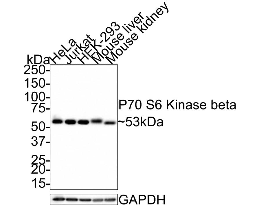 Western Blot: p70 S6 Kinase beta/S6K2 Antibody (JE35-69) [NBP3-32704] - Western blot analysis of p70 S6 Kinase beta/S6K2 on different lysates with Rabbit anti-p70 S6 Kinase beta/S6K2 antibody (NBP3-32704) at 1/1,000 dilution. Lane 1: HeLa cell lysate, 20 ug/Lane Lane 2: Jurkat cell lysate, 20 ug/Lane Lane 3: HEK-293 cell lysate, 20 ug/Lane Lane 4: Mouse liver tissue lysate, 40 ug/Lane Lane 5: Mouse kidney tissue lysate, 40 ug/Lane Predicted band size: 53 kDa Observed band size: 53 kDa Exposure time: 1 minute; 4-20% SDS-PAGE gel. Proteins were transferred to a PVDF membrane and blocked with 5% NFDM/TBST for 1 hour at room temperature. The primary antibody (NBP3-32704) at 1/1,000 dilution was used in 5% NFDM/TBST at room temperature for 2 hours. Goat Anti-Rabbit IgG - HRP Secondary Antibody at 1:100,000 dilution was used for 1 hour at room temperature.