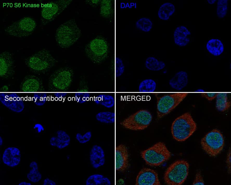 Immunocytochemistry/ Immunofluorescence: p70 S6 Kinase beta/S6K2 Antibody (JE35-69) [NBP3-32704] - Immunocytochemistry analysis of HeLa cells labeling p70 S6 Kinase beta/S6K2 with Rabbit anti-p70 S6 Kinase beta/S6K2 antibody (NBP3-32704) at 1/100 dilution. Cells were fixed in 4% paraformaldehyde for 10 minutes at 37 ℃, permeabilized with 0.05% Triton X-100 in PBS for 20 minutes, and then blocked with 2% negative goat serum for 30 minutes at room temperature. Cells were then incubated with Rabbit anti-p70 S6 Kinase beta/S6K2 antibody (NBP3-32704) at 1/100 dilution in 2% negative goat serum overnight at 4 ℃. Goat Anti-Rabbit IgG H&L (iFluor™ 488) was used as the secondary antibody at 1/1,000 dilution. Nuclear DNA was labelled in blue with DAPI. Beta tubulin (red) was stained at 1/100 dilution overnight at +4℃. Goat Anti-Mouse IgG H&L (iFluor™ 594) was used as the secondary antibody at 1/1,000 dilution.