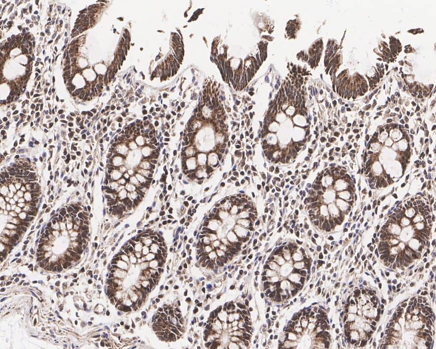 Immunohistochemistry: p70 S6 Kinase beta/S6K2 Antibody (JE35-69) [NBP3-32704] - Immunohistochemical analysis of paraffin-embedded human colon tissue with Rabbit anti-p70 S6 Kinase beta/S6K2 antibody (NBP3-32704) at 1/1,000 dilution. The section was pre-treated using heat mediated antigen retrieval with Tris-EDTA buffer (pH 9.0) for 20 minutes. The tissues were blocked in 1% BSA for 20 minutes at room temperature, washed with ddH2O and PBS, and then probed with the primary antibody (NBP3-32704) at 1/1,000 dilution for 1 hour at room temperature. The detection was performed using an HRP conjugated compact polymer system. DAB was used as the chromogen. Tissues were counterstained with hematoxylin and mounted with DPX.