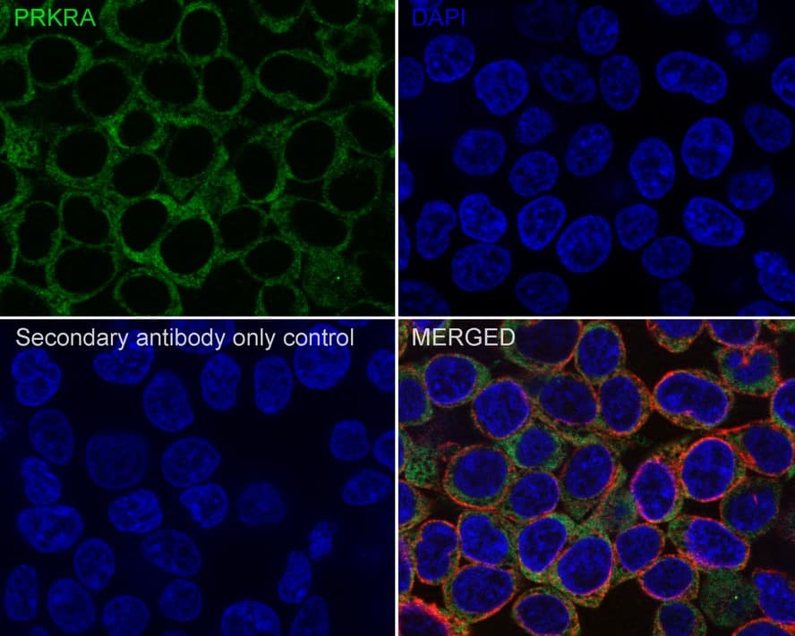 Immunocytochemistry/ Immunofluorescence: PACT Antibody (PSH02-14) [NBP3-32705] - Immunocytochemistry analysis of 293T cells labeling PACT with Rabbit anti-PACT antibody (NBP3-32705) at 1/100 dilution. Cells were fixed in 4% paraformaldehyde for 20 minutes at room temperature, permeabilized with 0.1% Triton X-100 in PBS for 5 minutes at room temperature, then blocked with 1% BSA in 10% negative goat serum for 1 hour at room temperature. Cells were then incubated with Rabbit anti-PACT antibody (NBP3-32705) at 1/100 dilution in 1% BSA in PBST overnight at 4 ℃. Goat Anti-Rabbit IgG H&L (iFluor™ 488) was used as the secondary antibody at 1/1,000 dilution. PBS instead of the primary antibody was used as the secondary antibody only control. Nuclear DNA was labelled in blue with DAPI. Beta tubulin (red) was stained at 1/100 dilution overnight at +4℃. Goat Anti-Mouse IgG H&L (iFluor™ 594) was used as the secondary antibody at 1/1,000 dilution.