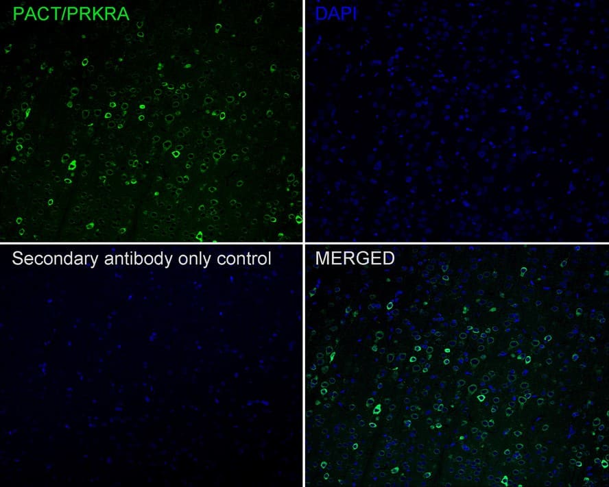 Immunohistochemistry: PACT Antibody (PSH02-14) [NBP3-32705] - Immunofluorescence analysis of paraffin-embedded rat brain tissue labeling PACT with Rabbit anti-PACT antibody (NBP3-32705) at 1/200 dilution. The section was pre-treated using heat mediated antigen retrieval with Tris-EDTA buffer (pH 9.0) for 20 minutes. The tissues were blocked in 10% negative goat serum for 1 hour at room temperature, washed with PBS, and then probed with the primary antibody (NBP3-32705, green) at 1/200 dilution overnight at 4 ℃, washed with PBS. Goat Anti-Rabbit IgG H&L (iFluor™ 488) was used as the secondary antibody at 1/1,000 dilution. Nuclei were counterstained with DAPI (blue).