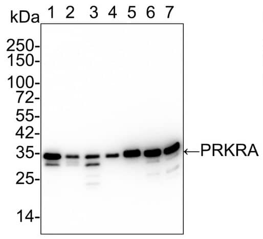 Western Blot: PACT Antibody (PSH02-14) [NBP3-32705] - Western blot analysis of PACT on different lysates with Rabbit anti-PACT antibody (NBP3-32705) at 1/2,000 dilution. Lane 1: K-562cell lysate Lane 2: HeLa cell lysate Lane 3: MCF7 cell lysate Lane 4: C2C12 cell lysate Lane 5: PC-12 cell lysate Lane 6: Mouse testis tissue lysate Lane 7: Rat testis tissue lysate Lysates/proteins at 20 µg/Lane. Predicted band size: 34 kDa Observed band size: 34 kDa Exposure time: 30 seconds; 4-20% SDS-PAGE gel. Proteins were transferred to a PVDF membrane and blocked with 5% NFDM/TBST for 1 hour at room temperature. The primary antibody at 1/2,000 dilution was used in 5% NFDM/TBST at 4℃ overnight. Goat Anti-Rabbit IgG - HRP Secondary Antibody at 1/50,000 dilution was used for 1 hour at room temperature.