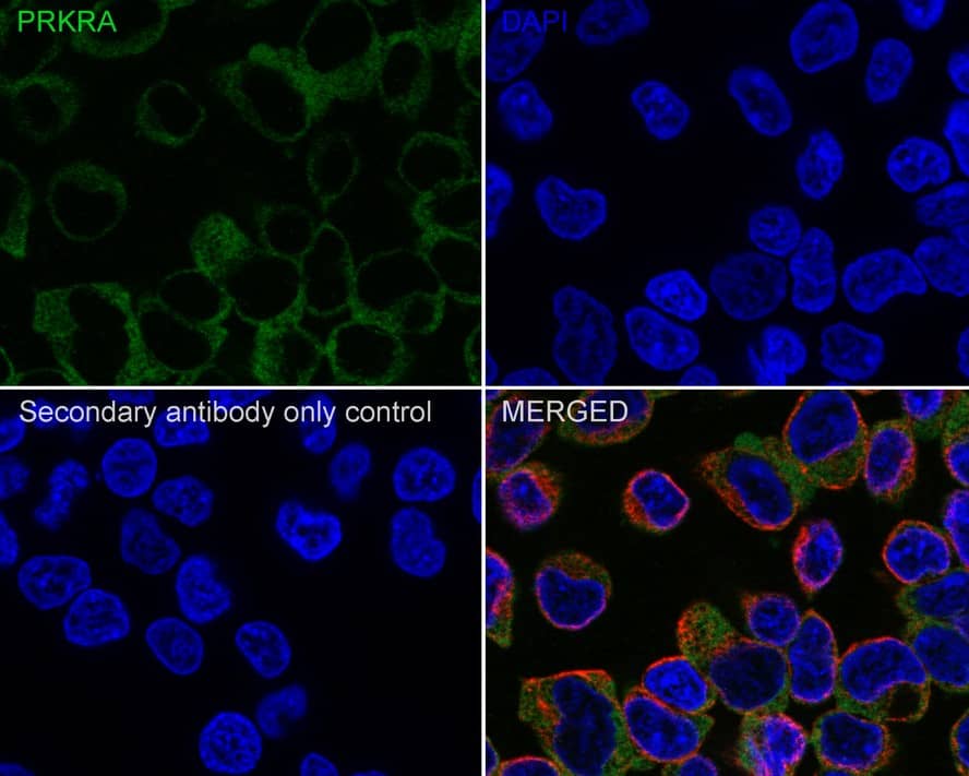 Immunocytochemistry/ Immunofluorescence: PACT Antibody (PSH02-15) [NBP3-32706] - Immunocytochemistry analysis of 293T cells labeling PACT with Rabbit anti-PACT antibody (NBP3-32706) at 1/100 dilution. Cells were fixed in 4% paraformaldehyde for 20 minutes at room temperature, permeabilized with 0.1% Triton X-100 in PBS for 5 minutes at room temperature, then blocked with 1% BSA in 10% negative goat serum for 1 hour at room temperature. Cells were then incubated with Rabbit anti-PACT antibody (NBP3-32706) at 1/100 dilution in 1% BSA in PBST overnight at 4 ℃. Goat Anti-Rabbit IgG H&L (iFluor™ 488) was used as the secondary antibody at 1/1,000 dilution. PBS instead of the primary antibody was used as the secondary antibody only control. Nuclear DNA was labelled in blue with DAPI. Beta tubulin (red) was stained at 1/100 dilution overnight at +4℃. Goat Anti-Mouse IgG H&L (iFluor™ 594) was used as the secondary antibody at 1/1,000 dilution.