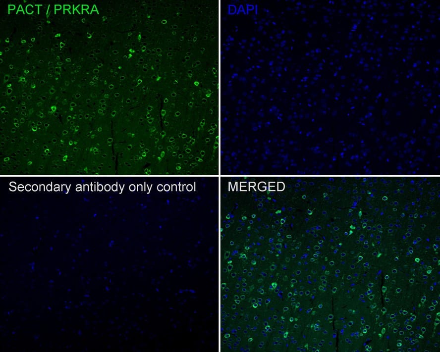 Immunohistochemistry: PACT Antibody (PSH02-15) [NBP3-32706] - Immunofluorescence analysis of paraffin-embedded rat cerebral cortex tissue labeling PACT with Rabbit anti-PACT antibody (NBP3-32706) at 1/200 dilution. The section was pre-treated using heat mediated antigen retrieval with Tris-EDTA buffer (pH 9.0) for 20 minutes. The tissues were blocked in 10% negative goat serum for 1 hour at room temperature, washed with PBS, and then probed with the primary antibody (NBP3-32706, green) at 1/200 dilution overnight at 4 ℃, washed with PBS. Goat Anti-Rabbit IgG H&L (iFluor™ 488) was used as the secondary antibody at 1/1,000 dilution. Nuclei were counterstained with DAPI (blue).