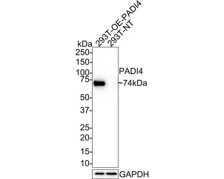 Western blot analysis on different lysates with NBP3-32707 at 1/1,000 dilution. Lane 1: 293T overexpress PADI4 whole cell lysate Lane 2: 293T whole cell lysate Lysates/proteins at 20 µg/Lane. Predicted band size: 74 kDa Observed band size: 74 kDa Exposure time: 1 minute; 4-20% SDS-PAGE gel. Proteins were transferred to a PVDF membrane and blocked with 5% NFDM/TBST for 1 hour at room temperature. NBP3-32707 at 1/1,000 dilution was used in 5% NFDM/TBST at room temperature for 2 hours. Goat Anti-Rabbit IgG [HRP] Secondary Antibody at 1:100,000 dilution was used for 1 hour at room temperature.
