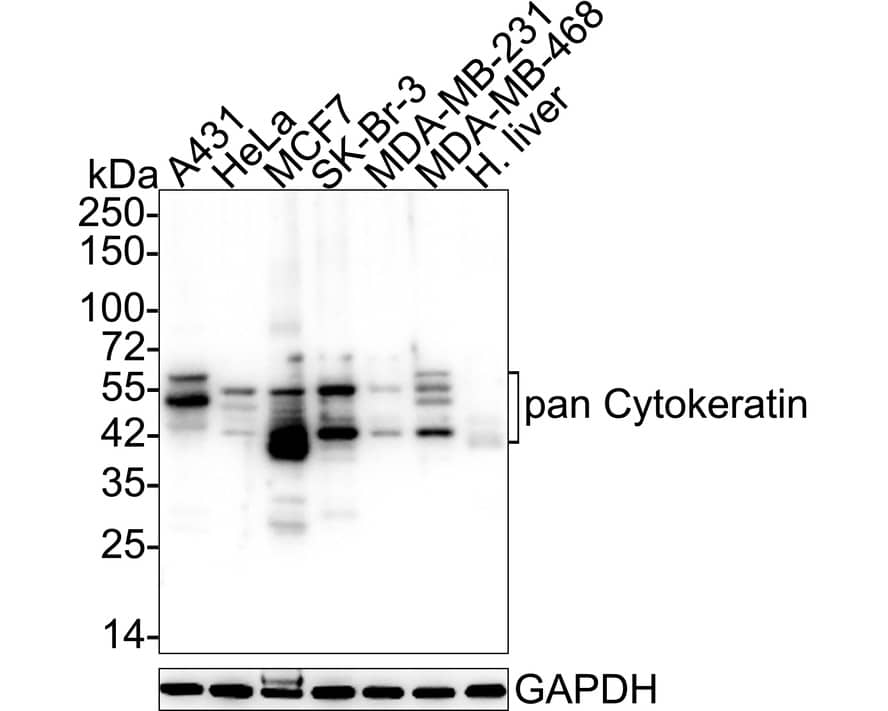 Western blot analysis on different lysates with NBP3-32711 at 1/2,000 dilution. Lane 1: A431 cell lysate (10 µg/Lane) Lane 2: HeLa cell lysate (10 µg/Lane) Lane 3: MCF7 cell lysate (10 µg/Lane) Lane 4: SK-Br-3 cell lysate (10 µg/Lane) Lane 5: MDA-MB-231 cell lysate (10 µg/Lane) Lane 6: MDA-MB-468 cell lysate (10 µg/Lane) Lane 7: Human liver tissue lysate (20 µg/Lane) Exposure time: 4 seconds;  4-20% SDS-PAGE gel. Proteins were transferred to a PVDF membrane and blocked with 5% NFDM/TBST for 1 hour at room temperature. NBP3-32711 at 1/2,000 dilution was used in 5% NFDM/TBST at room temperature for 2 hours. Goat anti-Mouse IgG [HRP] at 1/50,000 dilution was used for 1 hour at room temperature.