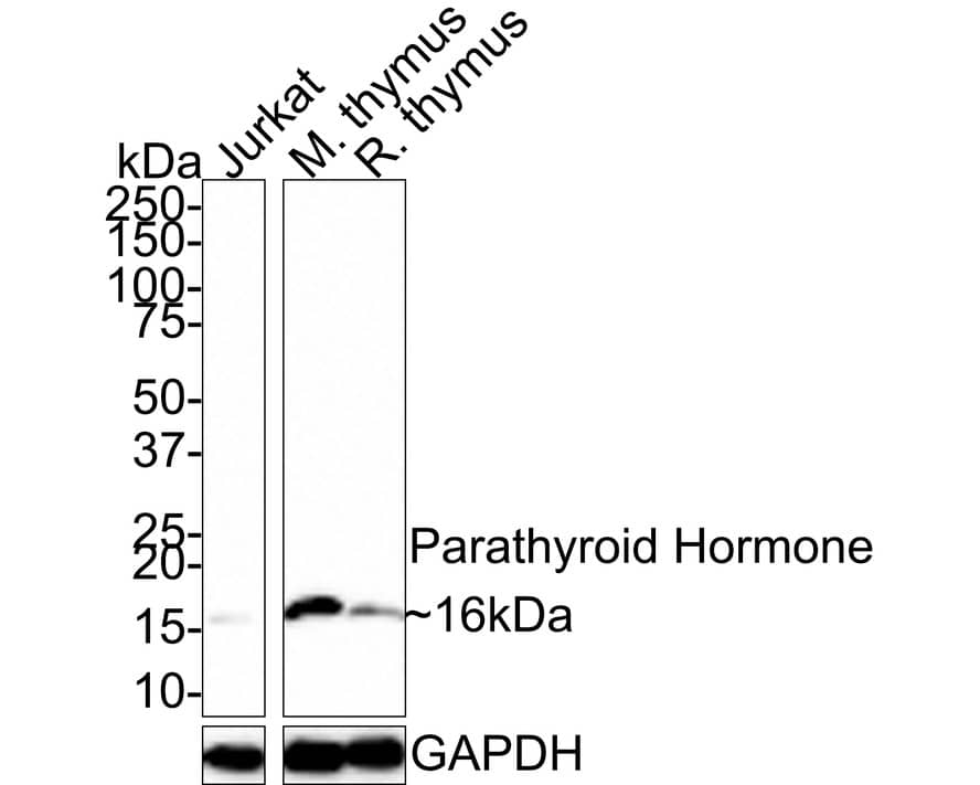 Western Blot: PTH Antibody (JE31-67) [NBP3-32716] - Western blot analysis of PTH on different lysates with Rabbit anti-PTH antibody (NBP3-32716) at 1/1,000 dilution. Lane 1: Jurkat cell lysate (15 ug/Lane) Lane 2: Mouse thymus tissue lysate (30 ug/Lane) Lane 3: Rat thymus tissue lysate (30 ug/Lane) Predicted band size: 13 kDa Observed band size: 16 kDa Exposure time: 3 minutes; 4-20% SDS-PAGE gel. Proteins were transferred to a PVDF membrane and blocked with 5% NFDM/TBST for 1 hour at room temperature. The primary antibody (NBP3-32716) at 1/1,000 dilution was used in 5% NFDM/TBST at room temperature for 2 hours. Goat Anti-Rabbit IgG - HRP Secondary Antibody at 1:100,000 dilution was used for 1 hour at room temperature.