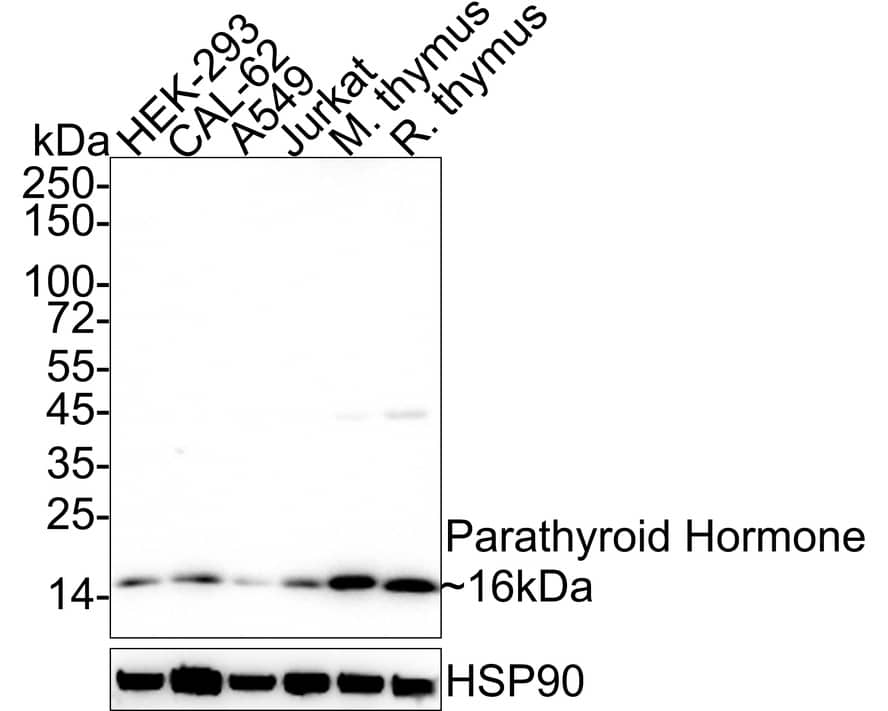 Western blot analysis on different lysates with NBP3-32717 at 1/1,000 dilution. Lane 1: HEK-293 cell lysate (20 µg/Lane) Lane 2: CAL-62 cell lysate (20 µg/Lane) Lane 3: A549 cell lysate (20 µg/Lane) Lane 4: Jurkat cell lysate (20 µg/Lane) Lane 5: Mouse thymus tissue lysate (40 µg/Lane) Lane 6: Rat thymus tissue lysate (40 µg/Lane) Predicted band size: 13 kDa Observed band size: 16 kDa Exposure time: 3 minutes; 4-20% SDS-PAGE gel. Proteins were transferred to a PVDF membrane and blocked with 5% NFDM/TBST for 1 hour at room temperature. NBP3-32717 at 1/1,000 dilution was used in 5% NFDM/TBST at 4℃ overnight. Goat Anti-Rabbit IgG [HRP] Secondary Antibody at 1/50,000 dilution was used for 1 hour at room temperature.