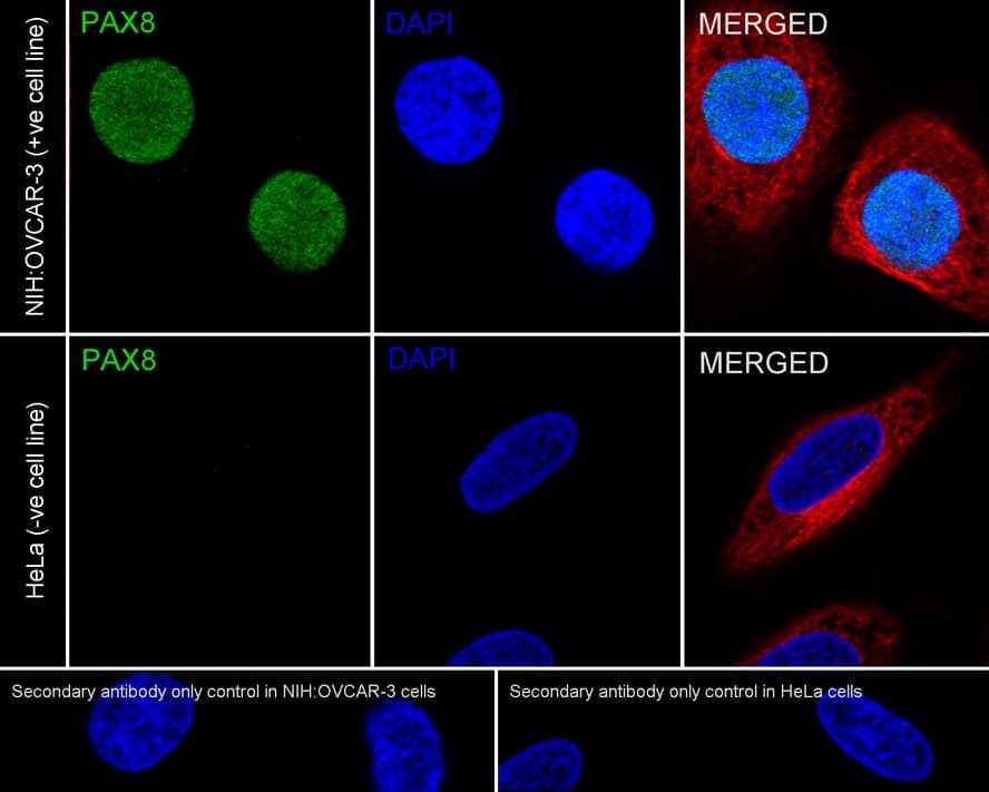 Immunocytochemistry/ Immunofluorescence: PAX8 Antibody (6G5-R) [NBP3-32719] - Immunocytochemistry analysis of NIH:OVCAR-3 (positive) and HeLa (negative) labeling PAX8 with Mouse anti-PAX8 antibody (NBP3-32719) at 1/100 dilution. Cells were fixed in 4% paraformaldehyde for 20 minutes at room temperature, permeabilized with 0.1% Triton X-100 in PBS for 5 minutes at room temperature, then blocked with 1% BSA in 10% negative goat serum for 1 hour at room temperature. Cells were then incubated with Mouse anti-PAX8 antibody (NBP3-32719) at 1/100 dilution in 1% BSA in PBST overnight at 4 ℃. Goat Anti-Mouse IgG H&L (iFluor™ 488) was used as the secondary antibody at 1/1,000 dilution. PBS instead of the primary antibody was used as the secondary antibody only control. Nuclear DNA was labelled in blue with DAPI. beta Tubulin (red) was stained at 1/100 dilution overnight at +4℃. Goat Anti-Rabbit IgG H&L (iFluor™ 594) were used as the secondary antibody at 1/1,000 dilution.