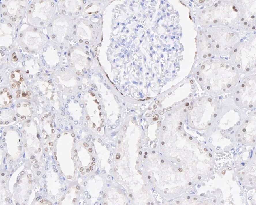 Immunohistochemistry: PAX8 Antibody (6G5-R) [NBP3-32719] - Immunohistochemical analysis of paraffin-embedded human kidney tissue with Mouse anti-PAX8 antibody (NBP3-32719) at 1/2,000 dilution. The section was pre-treated using heat mediated antigen retrieval with sodium citrate buffer (pH 6.0) for 2 minutes. The tissues were blocked in 1% BSA for 20 minutes at room temperature, washed with ddH2O and PBS, and then probed with the primary antibody (NBP3-32719) at 1/2,000 dilution for 1 hour at room temperature. The detection was performed using an HRP conjugated compact polymer system. DAB was used as the chromogen. Tissues were counterstained with hematoxylin and mounted with DPX.