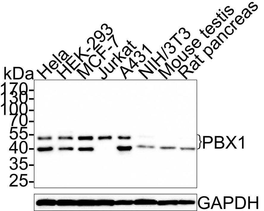 Western blot analysis on different lysates with NBP3-32720 at 1/1,000 dilution. Lane 1: Hela cell lysate (20 µg/Lane) Lane 2: HEK-293 cell lysate (20 µg/Lane) Lane 3: MCF-7 cell lysate (20 µg/Lane) Lane 4: Jurkat cell lysate (20 µg/Lane) Lane 5: A431 cell lysate (20 µg/Lane) Lane 6: NIH/3T3 cell lysate (20 µg/Lane) Lane 7: Mouse testis tissue lysate (40 µg/Lane) Lane 8: Rat pancreas tissue lysate (40 µg/Lane) Predicted band size: 47 kDa Observed band size: 40/47 kDa Exposure time: 3 minutes; 10% SDS-PAGE gel. Proteins were transferred to a PVDF membrane and blocked with 5% NFDM/TBST for 1 hour at room temperature. NBP3-32720 at 1/1,000 dilution was used in 5% NFDM/TBST at room temperature for 2 hours. Goat Anti-Rabbit IgG [HRP] Secondary Antibody at 1:300,000 dilution was used for 1 hour at room temperature.