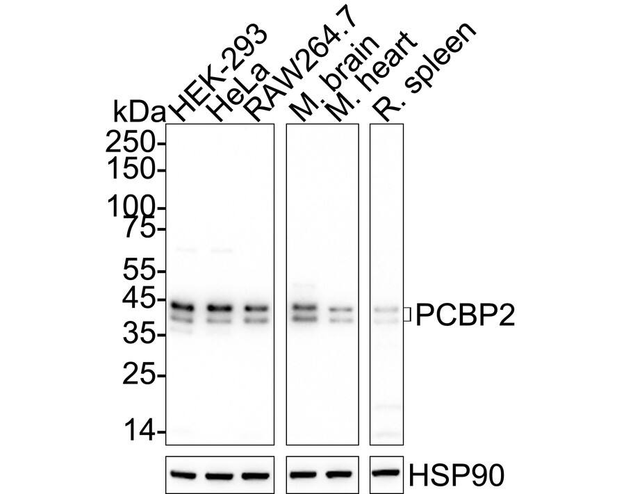 Western blot analysis on different lysates with NBP3-32724 at 1/2,000 dilution. Lane 1: HEK-293 cell lysate (10 µg/Lane) Lane 2: HeLa cell lysate (10 µg/Lane) Lane 3: RAW264.7 cell lysate (10 µg/Lane) Lane 4: Mouse brain tissue lysate (20 µg/Lane) Lane 5: Mouse heart tissue lysate (20 µg/Lane) Lane 6: Rat spleen tissue lysate (20 µg/Lane) Predicted band size: 39 kDa Observed band size: 39/42 kDa Exposure time: Lane 1-3: 1 minute 34 seconds; Lane 4-6: 3 minutes;  4-20% SDS-PAGE gel. Proteins were transferred to a PVDF membrane and blocked with 5% NFDM/TBST for 1 hour at room temperature. NBP3-32724 at 1/2,000 dilution was used in 5% NFDM/TBST at 4℃ overnight. Goat Anti-Rabbit IgG [HRP] Secondary Antibody at 1/50,000 dilution was used for 1 hour at room temperature.