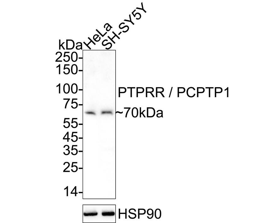 Western blot analysis on different lysates with NBP3-32726 at 1/5,000 dilution. Lane 1: HeLa cell lysate Lane 2: SH-SY5Y cell lysate Lysates/proteins at 20 µg/Lane. Predicted band size: 74 kDa Observed band size: 70 kDa Exposure time: 3 minutes;  4-20% SDS-PAGE gel. Proteins were transferred to a PVDF membrane and blocked with 5% NFDM/TBST for 1 hour at room temperature. NBP3-32726 at 1/5,000 dilution was used in primary antibody dilution at 4℃ overnight. Goat Anti-Rabbit IgG [HRP] Secondary Antibody at 1/50,000 dilution was used for 1 hour at room temperature.