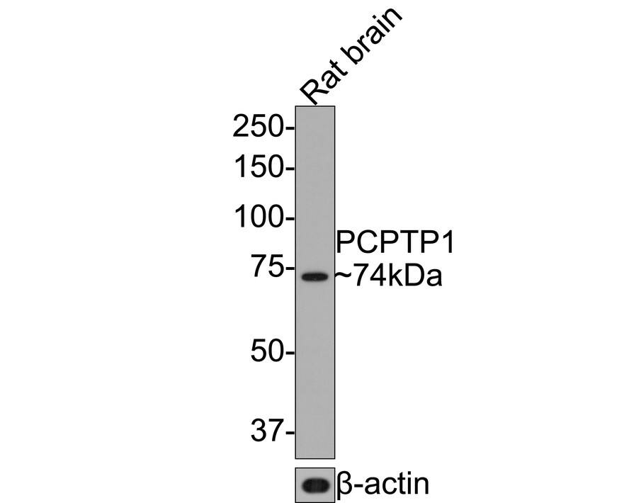 Western blot analysis of  Rat brain tissue lysates with NBP3-32726 at 1/500 dilution. Lysates/proteins at 20 µg/Lane. Predicted band size: 74 kDa Observed band size: 74 kDa Exposure time: 2 minutes; 8% SDS-PAGE gel. Proteins were transferred to a PVDF membrane and blocked with 5% NFDM/TBST for 1 hour at room temperature. NBP3-32726 at 1/500 dilution was used in 5% NFDM/TBST at room temperature for 2 hours. Goat Anti-Rabbit IgG [HRP] Secondary Antibody at 1:300,000 dilution was used for 1 hour at room temperature.
