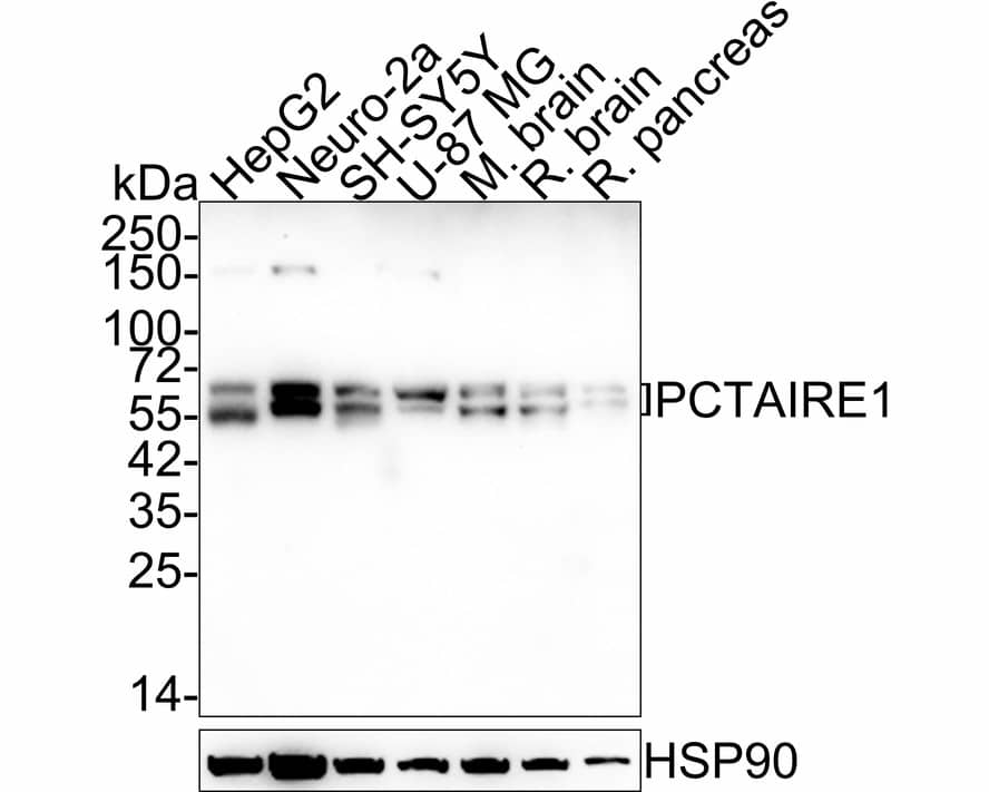 Western Blot: PCTAIRE1 Antibody (JE64-55) [NBP3-32727] - Western blot analysis of PCTAIRE1 on different lysates with Rabbit anti-PCTAIRE1 antibody (NBP3-32727) at 1/2,000 dilution. Lane 1: HepG2 cell lysate Lane 2: Neuro-2a cell lysate Lane 3: SH-SY5Y cell lysate Lane 4: U-87 MG cell lysate Lane 5: Mouse brain tissue lysate Lane 6: Rat brain tissue lysate Lane 7: Rat pancreas tissue lysate Lysates/proteins at 20 ug/Lane. Predicted band size: 56 kDa Observed band size: 56/63 kDa Exposure time: 2 minutes; 4-20% SDS-PAGE gel. Proteins were transferred to a PVDF membrane and blocked with 5% NFDM/TBST for 1 hour at room temperature. The primary antibody (NBP3-32727) at 1/2,000 dilution was used in 5% NFDM/TBST at 4  overnight. Goat Anti-Rabbit IgG - HRP Secondary Antibody at 1/50,000 dilution was used for 1 hour at room temperature.