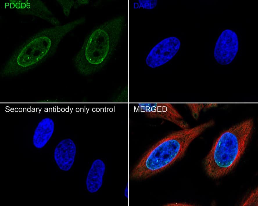 Immunocytochemistry/ Immunofluorescence: PDCD6 Antibody (A6A7-R) [NBP3-32728] - Immunocytochemistry analysis of HeLa cells labeling PDCD6 with Mouse anti-PDCD6 antibody (NBP3-32728) at 1/100 dilution. Cells were fixed in 4% paraformaldehyde for 20 minutes at room temperature, permeabilized with 0.1% Triton X-100 in PBS for 5 minutes at room temperature, then blocked with 1% BSA in 10% negative goat serum for 1 hour at room temperature. Cells were then incubated with Mouse anti-PDCD6 antibody (NBP3-32728) at 1/100 dilution in 1% BSA in PBST overnight at 4 ℃. Goat Anti-Mouse IgG H&L (iFluor™ 488) was used as the secondary antibody at 1/1,000 dilution. PBS instead of the primary antibody was used as the secondary antibody only control. Nuclear DNA was labelled in blue with DAPI. beta Tubulin (red) was stained at 1/100 dilution overnight at +4℃. Goat Anti-Rabbit IgG H&L (iFluor™ 594) were used as the secondary antibody at 1/1,000 dilution.