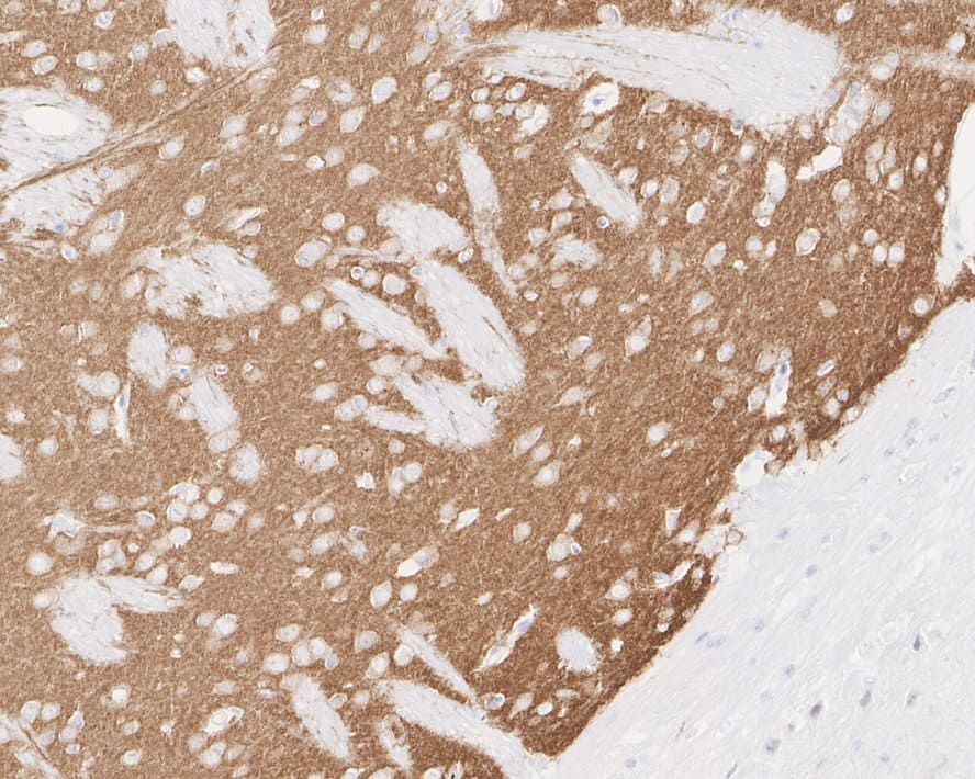 Immunohistochemistry: PDE10A Antibody (PSH03-61) [NBP3-32729] - Immunohistochemical analysis of paraffin-embedded mouse brain tissue with Rabbit anti-PDE10A antibody (NBP3-32729) at 1/20,000 dilution. The section was pre-treated using heat mediated antigen retrieval with Tris-EDTA buffer (pH 9.0) for 20 minutes. The tissues were blocked in 1% BSA for 20 minutes at room temperature, washed with ddH2O and PBS, and then probed with the primary antibody (NBP3-32729) at 1/20,000 dilution for 1 hour at room temperature. The detection was performed using an HRP conjugated compact polymer system. DAB was used as the chromogen. Tissues were counterstained with hematoxylin and mounted with DPX.