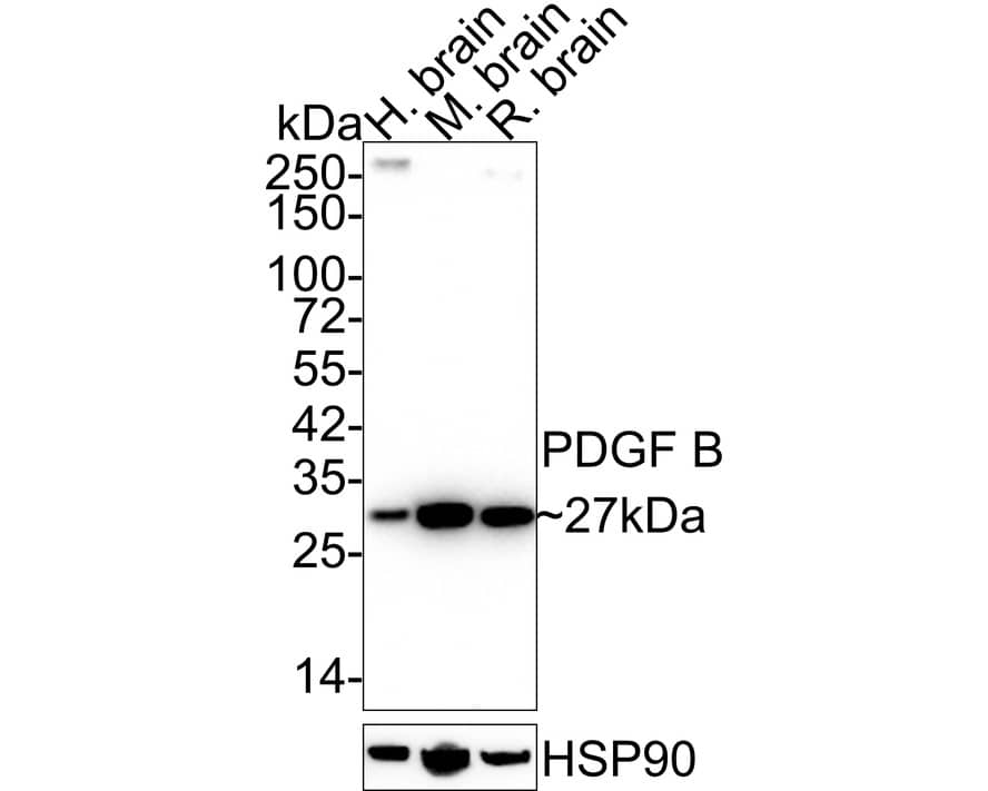 Western blot analysis on different lysates with NBP3-32730 at 1/2,000 dilution. Lane 1: Human brain tissue lysate Lane 2: Mouse brain tissue lysate Lane 3: Rat brain tissue lysate Lysates/proteins at 40 µg/Lane. Predicted band size: 27 kDa Observed band size: 27 kDa Exposure time: 2 minutes 18 seconds; 4-20% SDS-PAGE gel. Proteins were transferred to a PVDF membrane and blocked with 5% NFDM/TBST for 1 hour at room temperature. NBP3-32730 at 1/2,000 dilution was used in 5% NFDM/TBST at 4℃ overnight. Goat Anti-Rabbit IgG [HRP] Secondary Antibody at 1/50,000 dilution was used for 1 hour at room temperature.