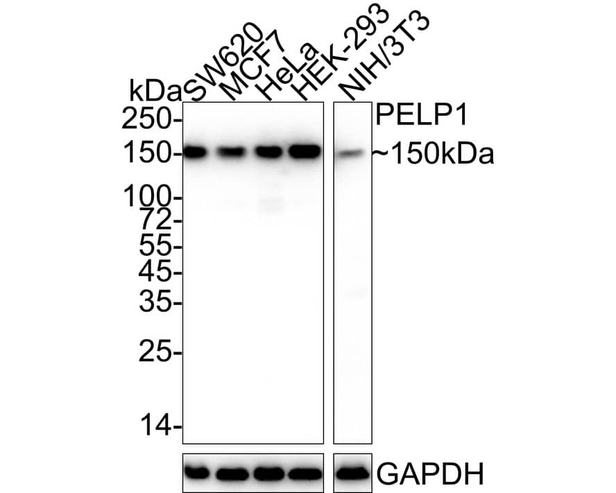 Western blot analysis on different lysates with NBP3-32734 at 1/1,000 dilution. Lane 1: SW620 cell lysate Lane 2: MCF7 cell lysate Lane 3: HeLa cell lysate Lane 4: HEK-293 cell lysate Lane 5: NIH/3T3 cell lysate Lysates/proteins at 20 µg/Lane. Predicted band size: 120 kDa Observed band size: 150 kDa Exposure time: Lane 1-4: 10 seconds; Lane 5: 40 seconds;  4-20% SDS-PAGE gel. Proteins were transferred to a PVDF membrane and blocked with 5% NFDM/TBST for 1 hour at room temperature. NBP3-32734 at 1/1,000 dilution was used in 5% NFDM/TBST at 4℃ overnight. Goat Anti-Rabbit IgG [HRP] Secondary Antibody at 1/50,000 dilution was used for 1 hour at room temperature.