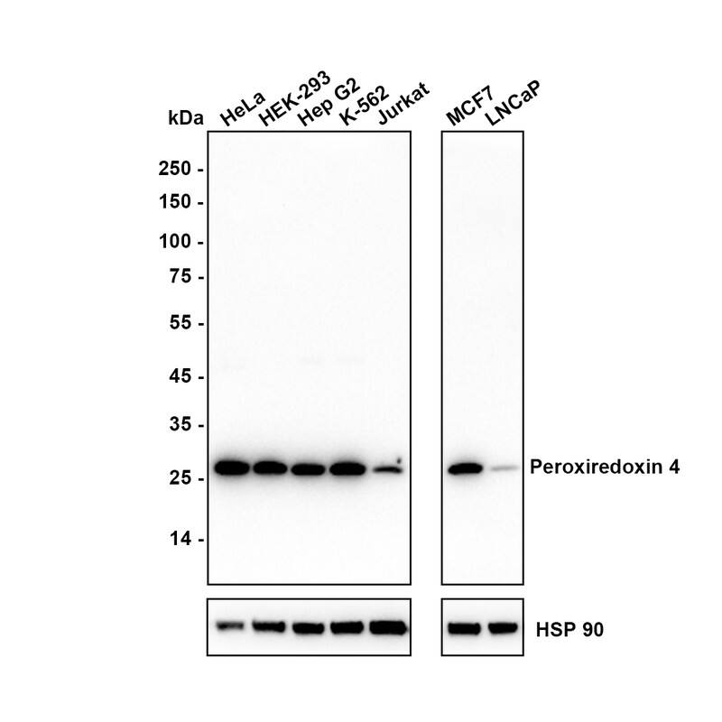 Western blot analysis on different lysates with NBP3-32739 at 1/2,000 dilution. Lane 1: HeLa cell lysate Lane 2: HEK-293 cell lysate Lane 3: HepG2 cell lysate Lane 4: K-562 cell lysate Lane 5: Jurkat cell lysate Lane 6: MCF7 cell lysate Lane 7: LNCaP cell lysate Lysates/proteins at 20 µg/Lane. Predicted band size: 31 kDa Observed band size: 27 kDa Exposure time: 50 seconds;  4-20% SDS-PAGE gel. Proteins were transferred to a PVDF membrane and blocked with 5% NFDM/TBST for 1 hour at room temperature. NBP3-32739 at 1/2,000 dilution was used in 5% NFDM/TBST at 4℃ overnight. Goat Anti-Rabbit IgG [HRP] Secondary Antibody at 1/50,000 dilution was used for 1 hour at room temperature.