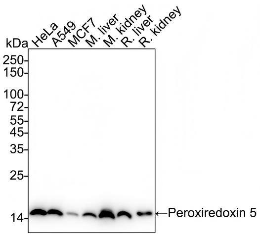 Western blot analysis on different lysates with NBP3-32740 at 1/50,000 dilution and competitor's antibody at 1/10,000 dilution. Lane 1: HeLa cell lysate (10 µg/Lane) Lane 2: A549 cell lysate (10 µg/Lane) Lane 3: MCF7 cell lysate (10 µg/Lane) Lane 4: Mouse liver tissue lysate (15 µg/Lane) Lane 5: Mouse kidney tissue lysate (15 µg/Lane) Lane 6: Rat liver tissue lysate (15 µg/Lane) Lane 7: Rat kidney tissue lysate (15 µg/Lane) Predicted band size: 22 kDa Observed band size: 17 kDa Exposure time: 10 seconds;  4-20% SDS-PAGE gel. Proteins were transferred to a PVDF membrane and blocked with 5% NFDM/TBST for 1 hour at room temperature. NBP3-32740 at 1/50,000 dilution and competitor's antibody at 1/10,000 dilution were used in 5% NFDM/TBST at 4℃ overnight. Goat Anti-Rabbit IgG [HRP] Secondary Antibody at 1/200,000 dilution was used for 1 hour at room temperature.