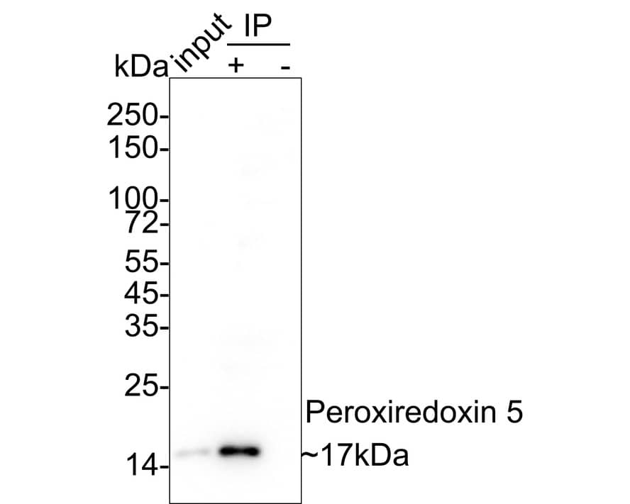 Immunoprecipitation: Peroxiredoxin 5 Antibody (PSH03-90) [NBP3-32740] - Peroxiredoxin 5 was immunoprecipitated in 0.2mg HeLa cell lysate with NBP3-32740 at 2 ug/25 ul agarose. Western blot was performed from the immunoprecipitate using NBP3-32740 at 1/5,000 dilution. Anti-Rabbit IgG for IP Nano-secondary antibody at 1/5,000 dilution was used for 1 hour at room temperature. Lane 1: HeLa cell lysate (input) Lane 2: NBP3-32740 IP in HeLa cell lysate Lane 3: Rabbit IgG instead of NBP3-32740 in HeLa cell lysate Blocking/Dilution buffer: 5% NFDM/TBST Exposure time: 43 seconds; ECL