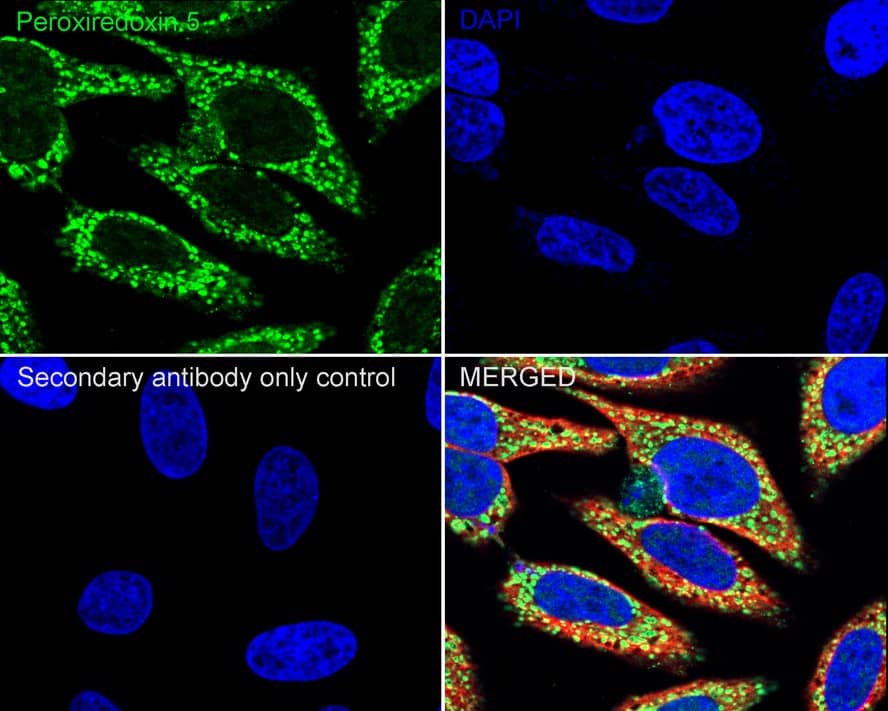 Immunocytochemistry/ Immunofluorescence: Peroxiredoxin 5 Antibody (PSH03-90) [NBP3-32740] - Immunocytochemistry analysis of HeLa cells labeling Peroxiredoxin 5 with Rabbit anti-Peroxiredoxin 5 antibody (NBP3-32740) at 1/100 dilution. Cells were fixed in 4% paraformaldehyde for 20 minutes at room temperature, permeabilized with 0.1% Triton X-100 in PBS for 5 minutes at room temperature, then blocked with 1% BSA in 10% negative goat serum for 1 hour at room temperature. Cells were then incubated with Rabbit anti-Peroxiredoxin 5 antibody (NBP3-32740) at 1/100 dilution in 1% BSA in PBST overnight at 4 ℃. Goat Anti-Rabbit IgG H&L (iFluor™ 488) was used as the secondary antibody at 1/1,000 dilution. PBS instead of the primary antibody was used as the secondary antibody only control. Nuclear DNA was labelled in blue with DAPI. Beta tubulin (red) was stained at 1/100 dilution overnight at +4℃. Goat Anti-Mouse IgG H&L (iFluor™ 594) was used as the secondary antibody at 1/1,000 dilution.