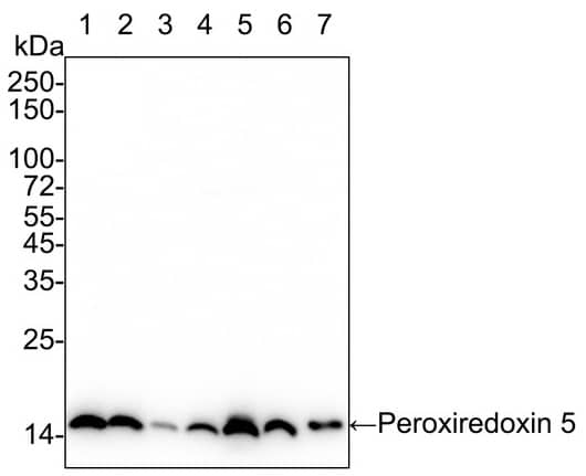 Western Blot: Peroxiredoxin 5 Antibody (PSH03-90) [NBP3-32740] - Western blot analysis of Peroxiredoxin 5 on different lysates with Rabbit anti-Peroxiredoxin 5 antibody (NBP3-32740) at 1/50,000 dilution. Lane 1: HeLa cell lysate (10 µg/Lane) Lane 2: A549 cell lysate (10 µg/Lane) Lane 3: MCF7 cell lysate (10 µg/Lane) Lane 4: Mouse liver tissue lysate (15 µg/Lane) Lane 5: Mouse kidney tissue lysate (15 µg/Lane) Lane 6: Rat liver tissue lysate (15 µg/Lane) Lane 7: Rat kidney tissue lysate (15 µg/Lane) Predicted band size: 22 kDa Observed band size: 17 kDa Exposure time: 10 seconds; 4-20% SDS-PAGE gel. Proteins were transferred to a PVDF membrane and blocked with 5% NFDM/TBST for 1 hour at room temperature. The primary antibody at 1/50,000 dilution was used in 5% NFDM/TBST at 4℃ overnight. Goat Anti-Rabbit IgG - HRP Secondary Antibody at 1/200,000 dilution was used for 1 hour at room temperature.