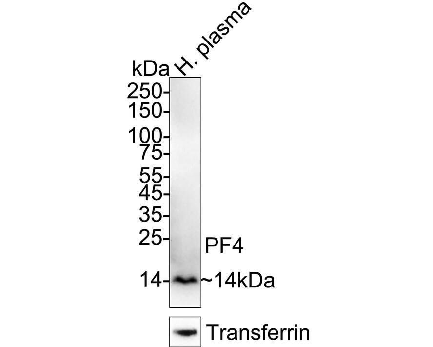 Western blot analysis of  human plasma lysates with NBP3-32743 at 1/1,000 dilution. Lysates/proteins at 30 µg/Lane. Predicted band size: 11 kDa Observed band size: 14 kDa Exposure time: 3 minutes; 4-20% SDS-PAGE gel. Proteins were transferred to a PVDF membrane and blocked with 5% NFDM/TBST for 1 hour at room temperature. NBP3-32743 at 1/1,000 dilution was used in 5% NFDM/TBST at 4℃ overnight. Goat Anti-Rabbit IgG [HRP] Secondary Antibody at 1/50,000 dilution was used for 1 hour at room temperature.