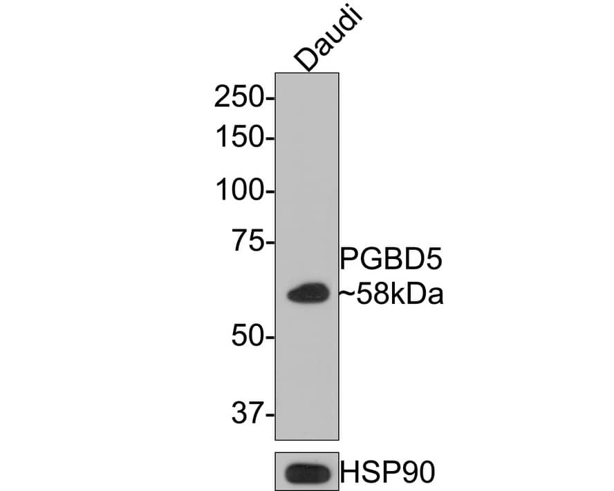 Western Blot PGBD5 Antibody