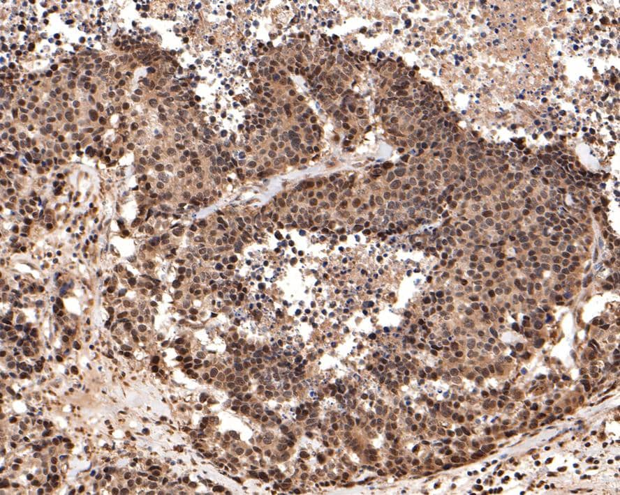 Immunohistochemistry PGBD5 Antibody