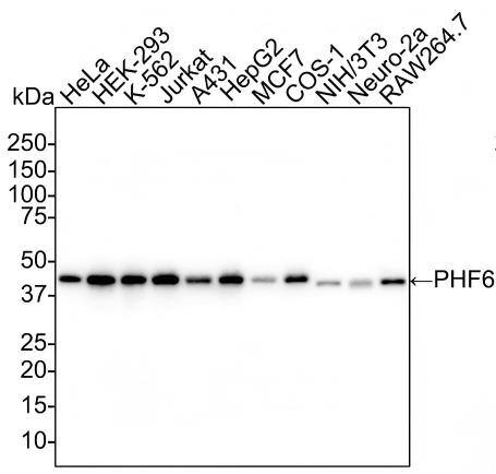 Western blot analysis on different lysates with NBP3-32746 at 1/1,000 dilution and competitor's antibody at 1/1,000 dilution. Lane 1: HeLa cell lysate (20 µg/Lane) Lane 2: HEK-293 cell lysate (20 µg/Lane) Lane 3: K-562 cell lysate (20 µg/Lane) Lane 4: Jurkat cell lysate (20 µg/Lane) Lane 5: A431 cell lysate (20 µg/Lane) Lane 6: HepG2 cell lysate (20 µg/Lane) Lane 7: MCF7 cell lysate (20 µg/Lane) Lane 8: COS-1 cell lysate (20 µg/Lane) Lane 9: NIH/3T3 cell lysate (20 µg/Lane) Lane 10: Neuro-2a cell lysate (20 µg/Lane) Lane 11: RAW264.7 cell lysate (20 µg/Lane) Predicted band size: 41 kDa Observed band size: 41 kDa Exposure time: 20 seconds; 4-20% SDS-PAGE gel. Proteins were transferred to a PVDF membrane and blocked with 5% NFDM/TBST for 1 hour at room temperature. NBP3-32746 at 1/1,000 dilution and competitor's antibody at 1/1,000 dilution were used in 5% NFDM/TBST at 4℃ overnight. Goat Anti-Rabbit IgG [HRP] Secondary Antibody at 1/50,000 dilution was used for 1 hour at room temperature.